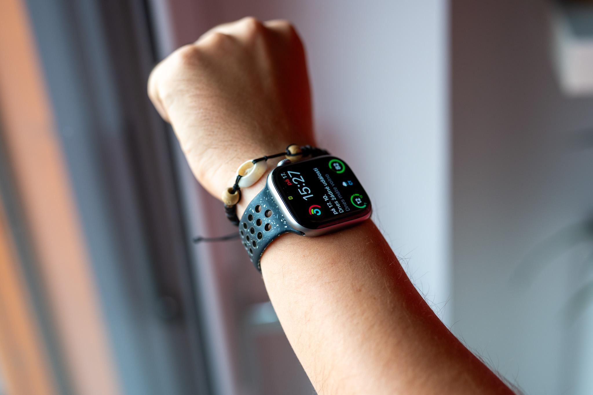 Apple Watch Series 12 un tā iespējamā revolūcija ar sensoriem uz siksniņas